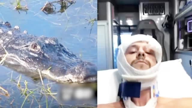 【美国男子潜水遭鳄鱼一口含住头 头骨被咬碎惊魂逃命:像被船猛撞】近日,美国佛罗里达州一名2