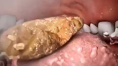 一个视频告诉你食物从口腔进入人体后,消化系统的完整工作流程。