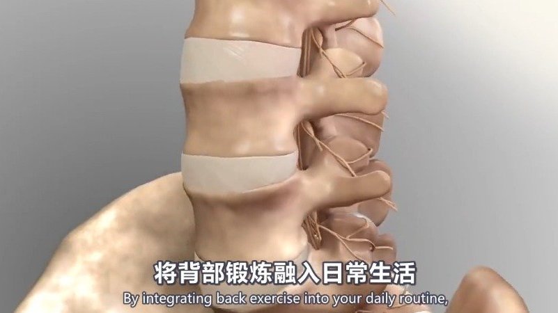 #传递科普正能量# 医学双语科普:慢性腰痛——了解下背部解剖和治疗方法腰间盘突出只能吃止疼