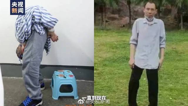 【医者仁心!全国人大代表迟到反被点赞 为抢救病人临时加急进行手术】全国人大代表,成都市第三