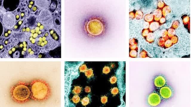 【新冠与HIV病毒相似 鸡尾酒疗法或成优选方案 免疫学专家这样解释】鸡尾酒疗法 #新冠病毒