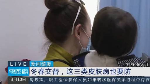 【注意!#冬春交替谨防这3类皮肤病# #有些皮肤病不及时就医或危急生命#】天气转暖,细菌和