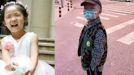 【难忍化疗脱发!7岁患癌女娃剃发变装成酷帅男孩】7岁女孩文文患有横纹肌肉瘤(恶性肿瘤)。治