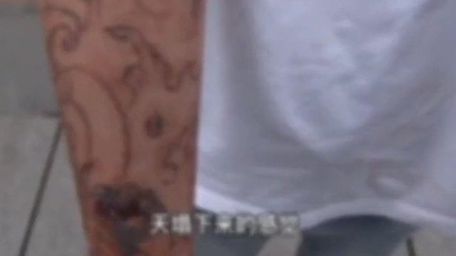 近日,辽宁丹东。14岁的小羽在手臂上大面积纹身,现在因纹身不敢上学。小羽的妈妈林女士很痛心