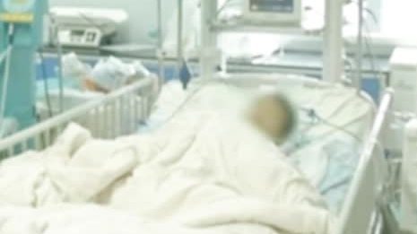 【11岁男孩吃变质鱿鱼致肾衰竭 鱿鱼此前在冰箱存放一周】近日,广东东莞11岁男孩小豪在吃完