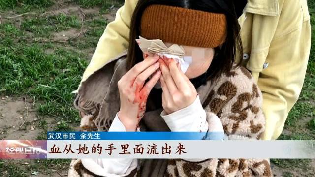 【#除草作业离太近女子被意外割伤脸# 视力仅剩0.25】3月19日,武汉的余先生一家三口和