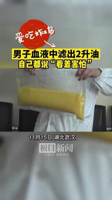 【“看着害怕”...#男子体检血中抽出2升油浆#[呆]】武汉的王先生今年33岁,经常不吃早