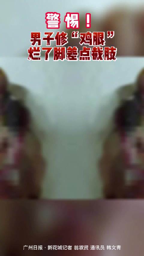 【警惕!患糖尿病男子修鸡眼致脚趾被截】今天是“联合国糖尿病日”。临床上,有些糖尿病患者因管